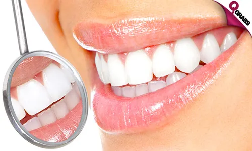 Zoom Teeth Whitening, Home Bleaching, Scaling & Polishing!